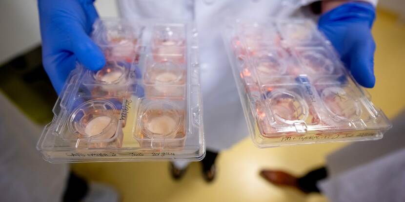 Researcher shows well plates with 3D skin models of human cells